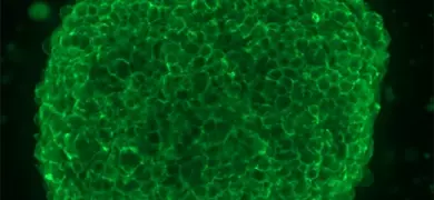 A bright-green, fluorescent, EGFR stain sphere with a black background.