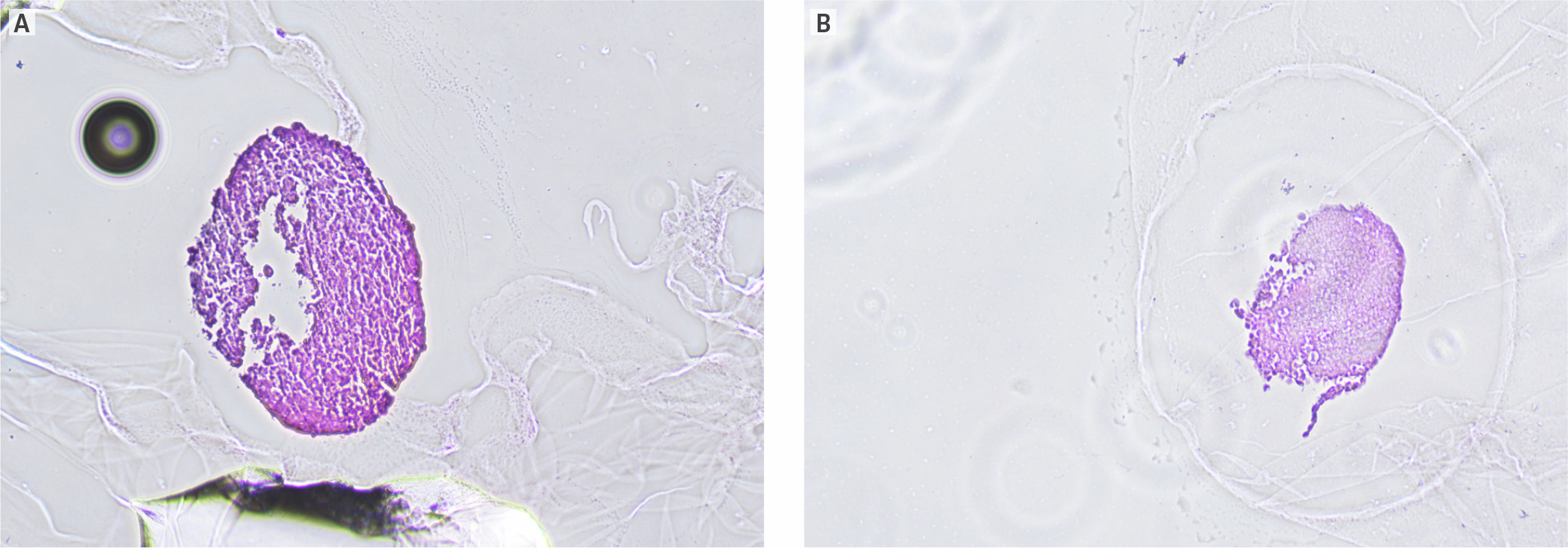 A two‑panel image shows formalin‑fixed, paraffin‑embedded spheroid sections stained for structural evaluation. Panel A displays a large spheroid from a U‑bottom plate grown in McCoy’s 5A medium with a visible necrotic core, while Panel B shows a smaller, structurally intact spheroid produced in a ThawReady™ plate using Aggregation Medium.
