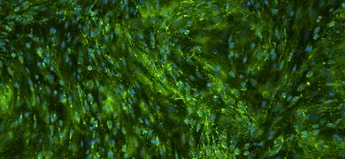A fluorescent microscopic image of gingival fibroblast shows numerous blue-stained cell nuclei scattered throughout a green-stained fibrous matrix, indicating the presence of cells within a tissue sample.