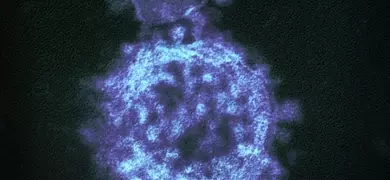 Highly magnified, digitally colorized transmission electron microscopic (TEM) image reveals ultrastructural details exhibited by three, spherical shaped, Middle East respiratory syndrome coronavirus (MERS-CoV) virions.