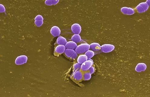 A small group of Gram-positive, Enterococcus faecalis bacteria, formerly known as Streptococcus faecalis