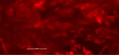Red renal proximal tubular epithelial cells.