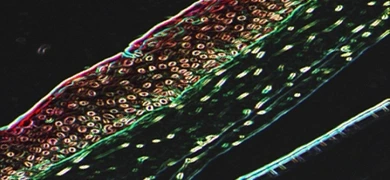 Fluorescent microscopy image of human skin cells expressing telomerase reverse transcriptase, showing layered cells in red, brown, and green against a dark backgroun