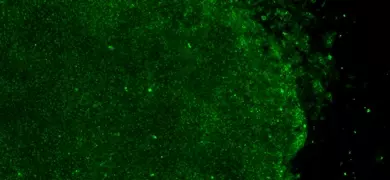 induced-pluripotent-stem-cells-iPSC