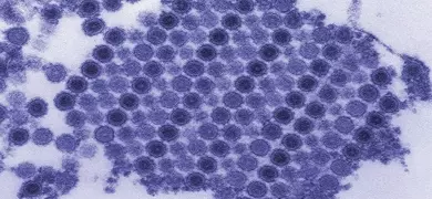 17550-digitally-colorized transmission electron micrograph (TEM) depicts numerous Chikungunya virus particles-Cynthia GoldsmithCDC.jpg