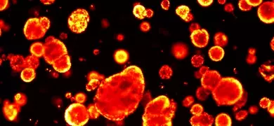Microscopic image showing red-orange fluorescent particles of varying sizes scattered against a dark background, highlighting internal cell structures.