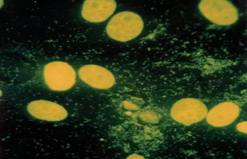 Flat, fluorescent yellow mycoplasma spheres.