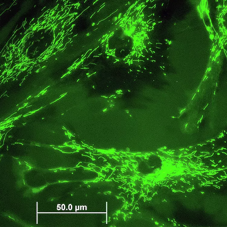 Green fluorescent mitochondria in 895 Sk cells.