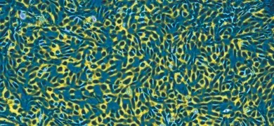 Small, rod-shaped, fluorscent blue and yellow  human umbilical vein endothelial cells.