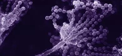 Purple strands of grape-like Aspergillosis fungus.