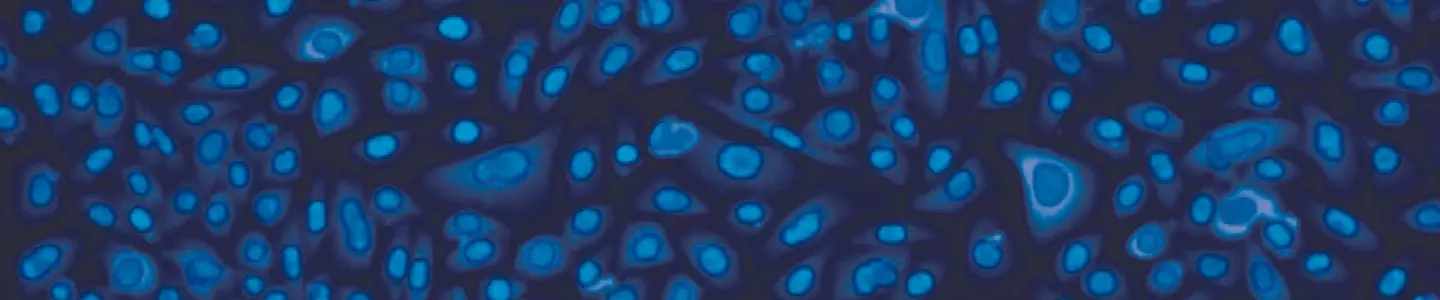 lung epithelial cystic fibrosis cells