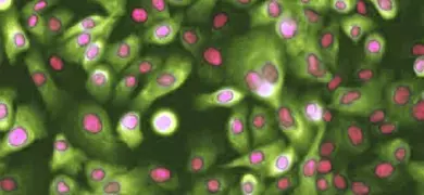 Fluorescent microscopy image showing hTERT-immortalized mammary epithelial cells stained with PcytoKmodcr. The cells are highlighted in green, while the nuclei are stained pink.