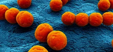 3d rendered orange balls of Streptococcus bacteria.