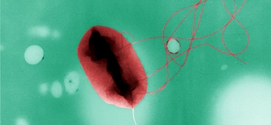 Colorized electron microscope image shows an Escherichia coli O157:H7 bacterium with multiple flagella extending from its surface, using the pseudo-replica technique.