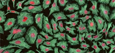 Microscopic image of HeLa cells stained with green, red, and pink colors. The cells have green cytoplasm with red nuclei and pink nucleoli.