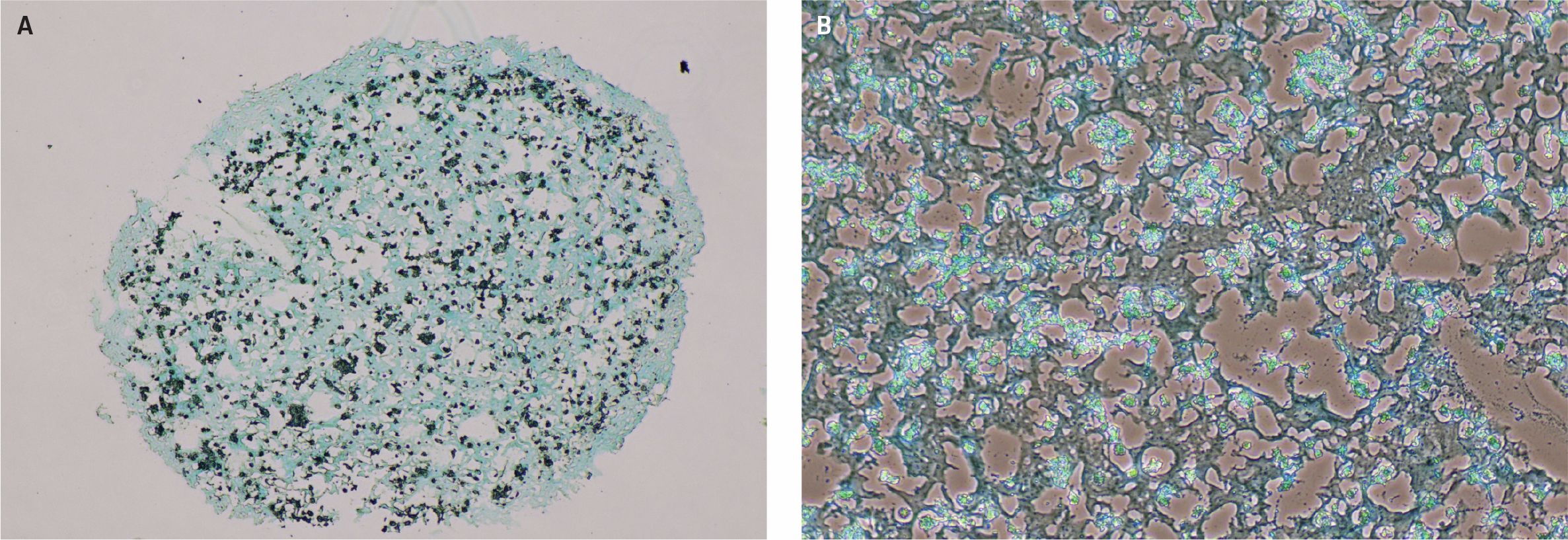Microscopic images showing Alcian blue staining of glycosaminoglycans after chondrogenic differentiation of DSCS cells: (A) 4X magnification of a cell aggregate stained blue and (B) 10X magnification showing detailed blue-stained GAGs distributed among differentiated chondrocytes.