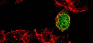 Fluorescent red and green West Nile virus.