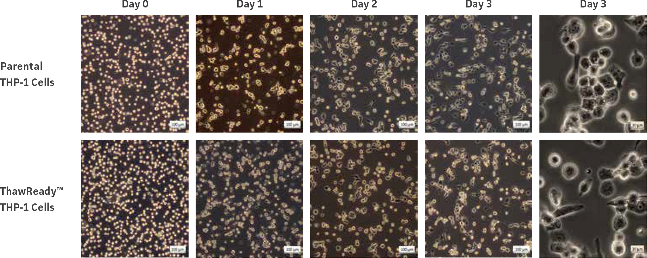 Morphological changes of macrophage-like cells with differentiation.