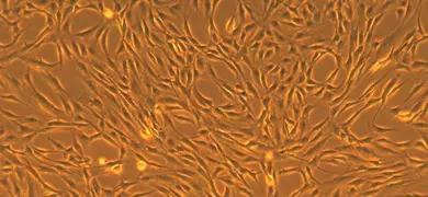 Long, fluorescent orange and brown embryonic human mesenchymal stem cells.
