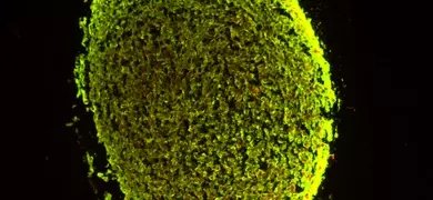 Fluorescent microscopy image of a neural progenitor cell-derived neurosphere, showing a dense, oval-shaped cluster of tightly packed cells with bright green fluorescence outlining the perimeter and scattered throughout the interior, set against a completely black background.