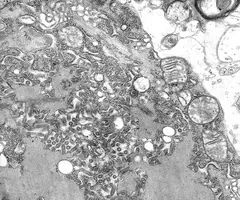 Transmission electron microscopic (TEM) image reveals some of the ultrastructural features exhibited by numerous bullet-shaped, rabies virus particles, as well as cellular inclusions known as Negri bodies.