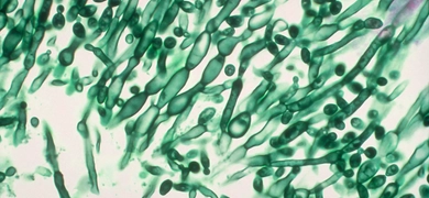 PHIL_1215 - Candida_Copyrighted image (CDC).tif