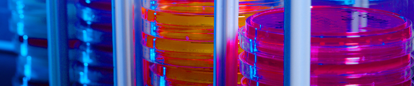 Stacked petri dishes containing pink and orange media.