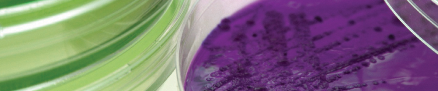 Petri dishes containing purple and green media.