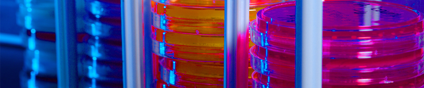 Several stacks of petri dishes containing various colored media, in rack.