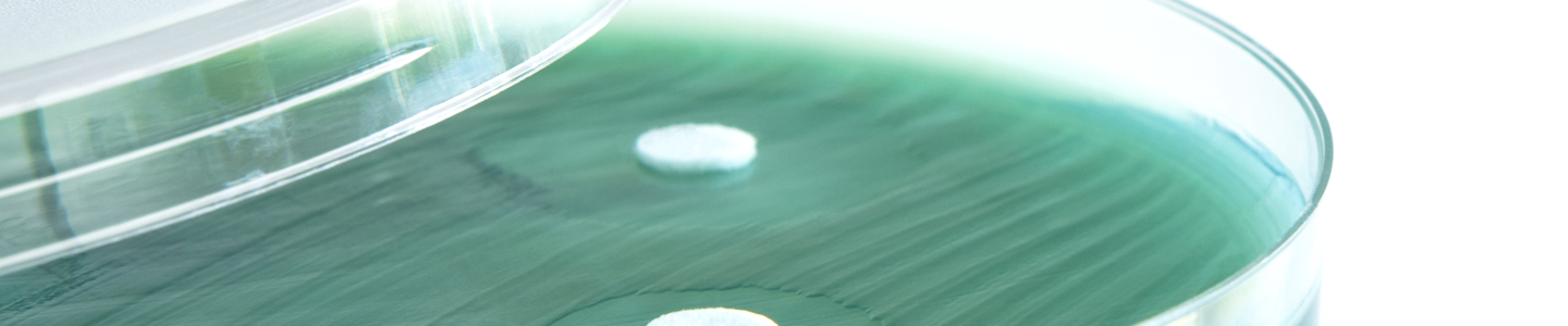 Green agar in petri dish, with lid partially off