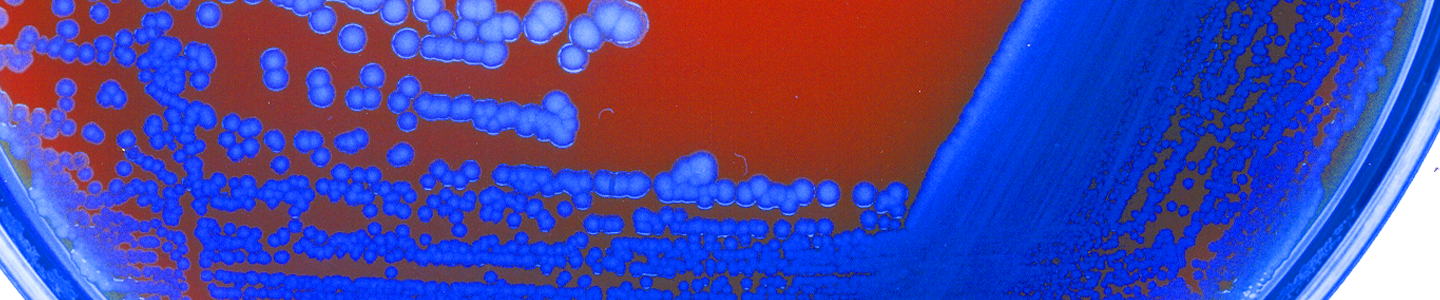 Blue bacteria cultures growing on red media in petri dish.