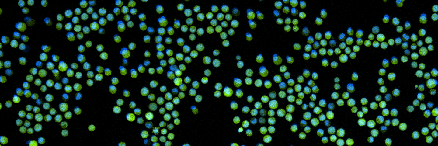 Green K562-GFP with nuclear stain.