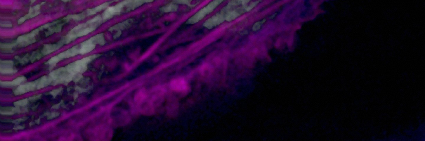 Purple and white human HeLa cancer cell cytokinesis.