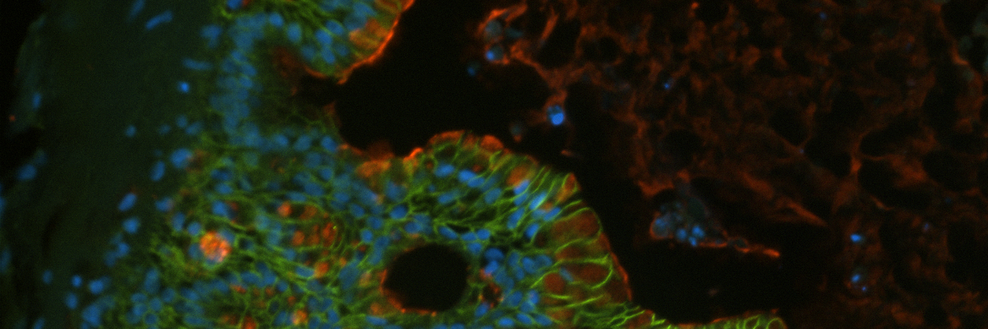 Green, orange, red and blue organoid cells.