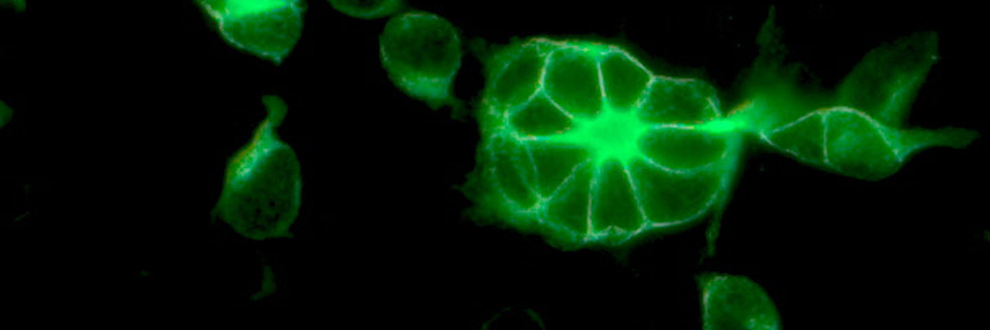 Green coronavirus using NCTC clone 929.
