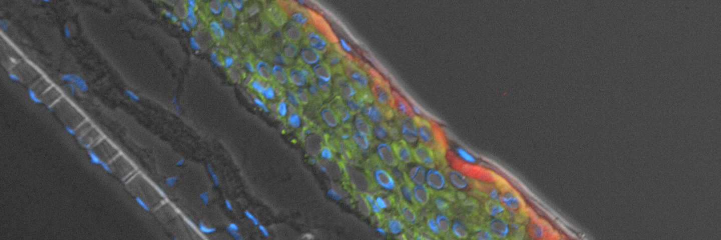 Green and red kidney cells.