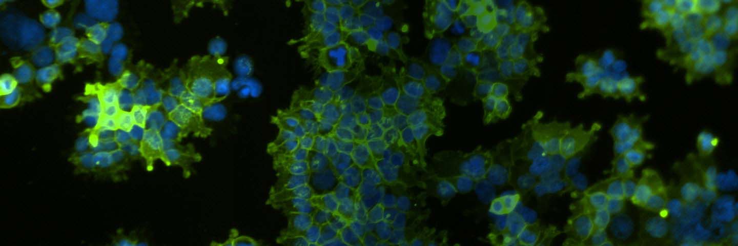 Green and blue human embryonic kidney cells.