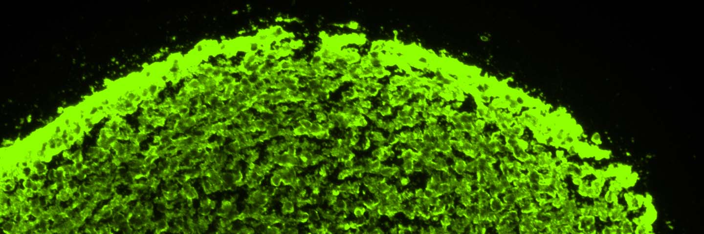 Neural progenitor cell-derived neurosphere green