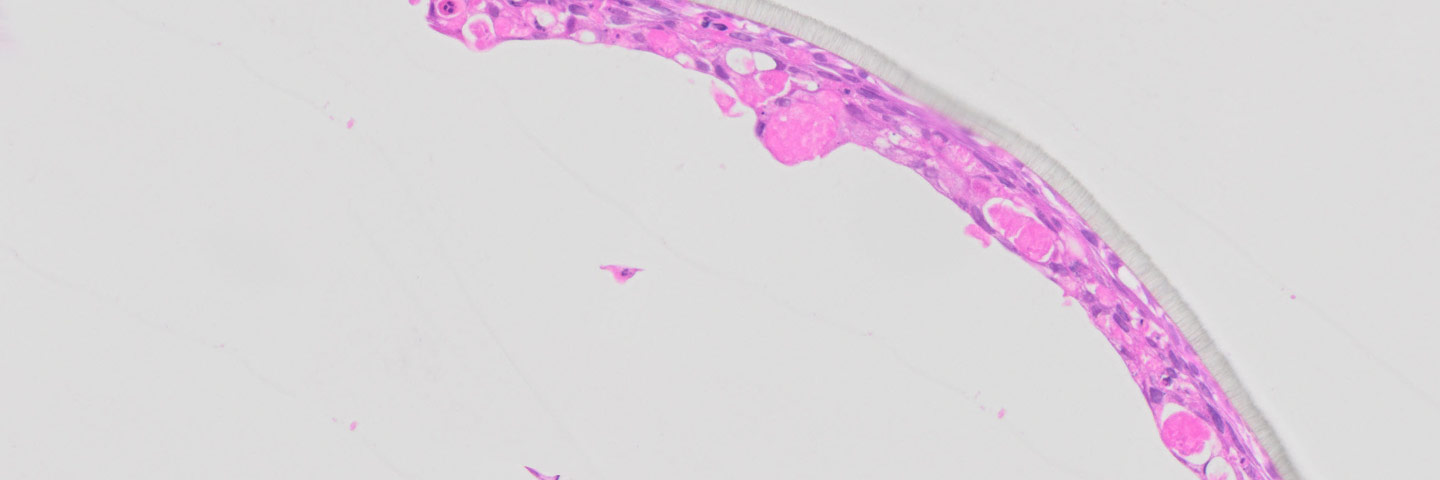 Pink, curved section of bronchial and fibroblast cells