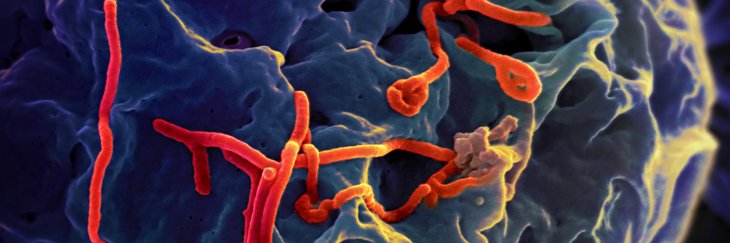 Long, thin, red, ebola rods stuck to a porous black-blue surface.