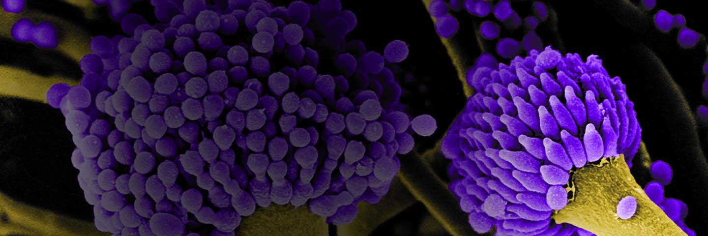 Green stem attached to a cluster of small, round, purple Aspergillus fumigatus.