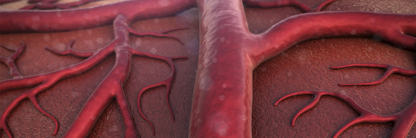 Closeup of thick red blood vessels.