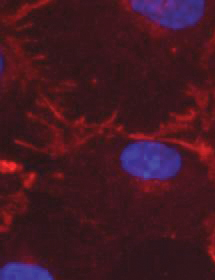 Purple, red and black human umbilical vein endothelial cells.