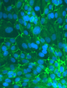 Green hTER renal proximal tubular epithelial cells.