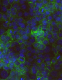 Fluorescent blue and green colon cells.