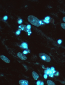 Blue m-fermentens mycoplasma cells.