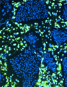 Green and blue conditionally reprogrammed organoid cells.