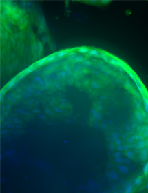 Grainy, round, fluorescent green and blue organoid cells.