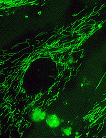 Green fluorescent mitochondria in 895 Sk cells.