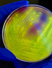 Blue-gloved hands holding a petri dish containing yellow clostridium difficile bacteria.